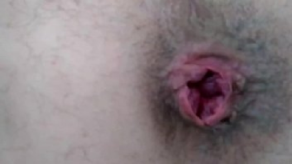 Red tube videos sexo anal arrombado